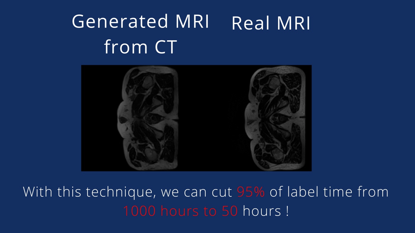 Generated MRI from CT scan vs Real MRI